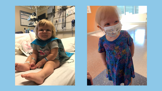 Graysen during her treatment at Kaiser Permanente Santa Clara Medical Center