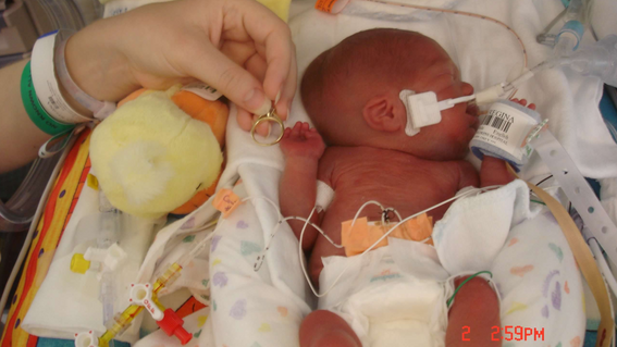 Baby Jonathan in the NICU