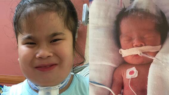 Raina during treatment